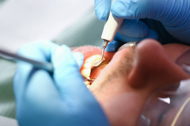 Best Emergency Dental Extractions in Muscle Shos, AL