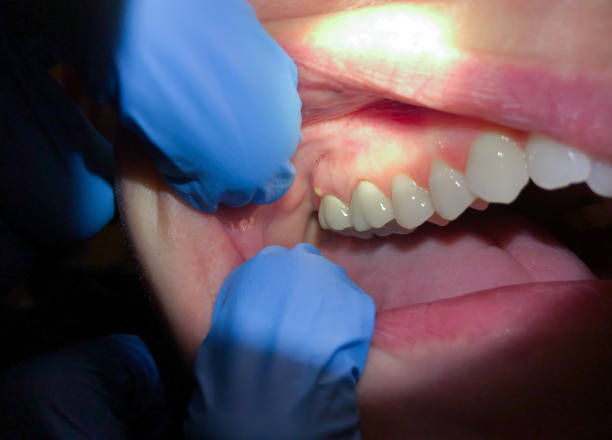Best Emergency Cosmetic Dentistry in Muscle Shos, AL